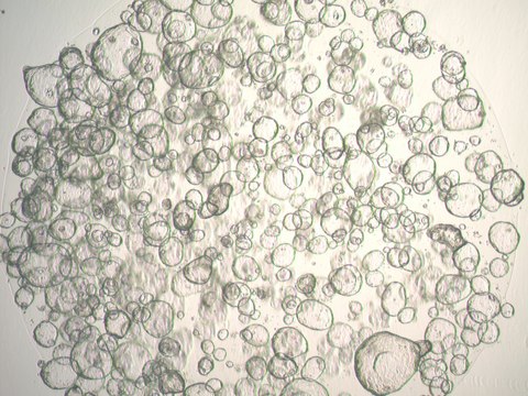 3dGRO Colon Intestinal Organoids, Age 24 (Prep ht-206-CR)