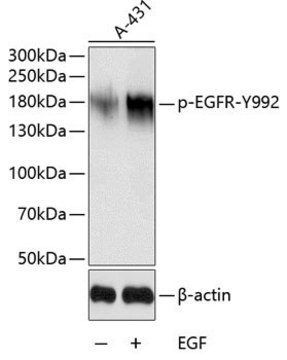 Anti-Phospho-EGFR-Y992 antibody produced in rabbit