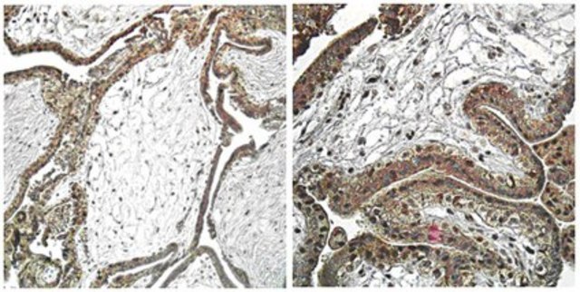 Anti-TLR2 Antibody from rabbit, purified by affinity chromatography