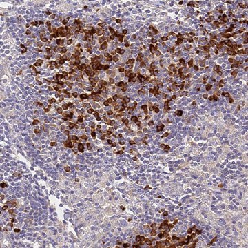 Anti-SLC11A1 antibody produced in rabbit Prestige Antibodies&#174; Powered by Atlas Antibodies, affinity isolated antibody, buffered aqueous glycerol solution