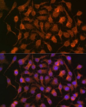 Anti-HSP70 Antibody, clone 5U9A0, Rabbit Monoclonal