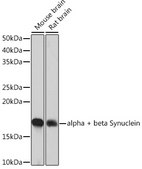Anti-alpha + beta Synuclein Antibody, clone 9E9X5, Rabbit Monoclonal