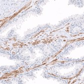 Anti-COL14A1 antibody produced in rabbit Prestige Antibodies® Powered by Atlas Antibodies, affinity isolated antibody, buffered aqueous glycerol solution