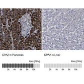 Anti-CPA2 antibody produced in rabbit Prestige Antibodies® Powered by Atlas Antibodies, affinity isolated antibody, buffered aqueous glycerol solution, Ab1