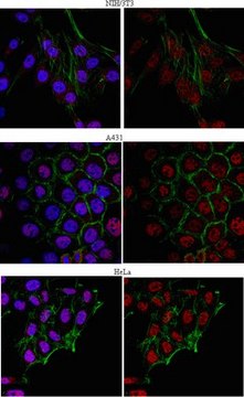 Anti-SRp30b (SC35) Antibody from rabbit