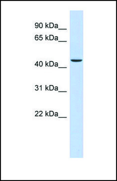 Anti-OGDH antibody produced in rabbit affinity isolated antibody