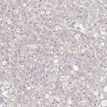 Anti-A1BG antibody produced in rabbit Prestige Antibodies&#174; Powered by Atlas Antibodies, affinity isolated antibody, buffered aqueous glycerol solution