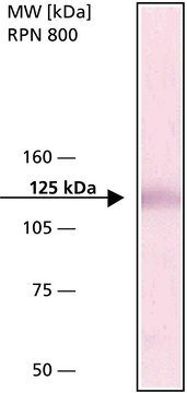 Anti-Focal Adhesion Kinase (pp125FAK) antibody produced in rabbit IgG fraction of antiserum, buffered aqueous solution