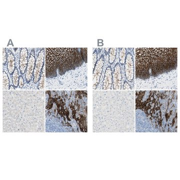 Anti-DSC2 antibody produced in rabbit Prestige Antibodies® Powered by Atlas Antibodies, affinity isolated antibody, buffered aqueous glycerol solution