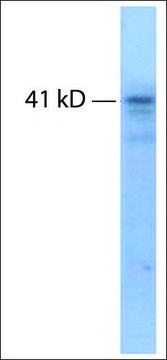 抗 TRHR 兔抗 IgG fraction of antiserum