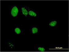 Monoclonal Anti-LIMD1 antibody produced in mouse clone 2G5, purified immunoglobulin, buffered aqueous solution