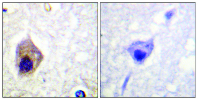 Anti-CASP1, C-Terminal antibody produced in rabbit affinity isolated antibody