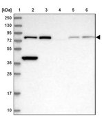 Anti-ERCC2 antibody produced in rabbit Prestige Antibodies® Powered by Atlas Antibodies, affinity isolated antibody, buffered aqueous glycerol solution