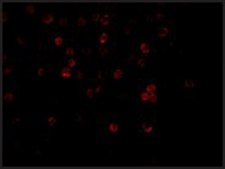 Anti-DCR1 (ab1) antibody produced in rabbit affinity isolated antibody, buffered aqueous solution