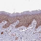 Anti-DHX8 antibody produced in rabbit Prestige Antibodies® Powered by Atlas Antibodies, affinity isolated antibody, buffered aqueous glycerol solution