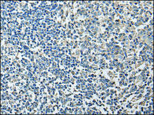 Anti-PLA2G16 affinity isolated antibody