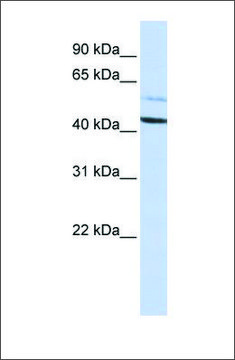 Anti-PSMD4 antibody produced in rabbit affinity isolated antibody