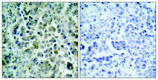 Anti-HDAC8 antibody produced in rabbit affinity isolated antibody