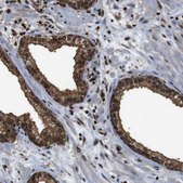 Anti-VCP antibody produced in rabbit Prestige Antibodies® Powered by Atlas Antibodies, affinity isolated antibody, buffered aqueous glycerol solution