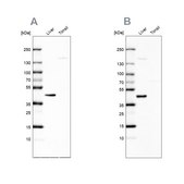 Anti-NADK2 antibody produced in rabbit Prestige Antibodies® Powered by Atlas Antibodies, affinity isolated antibody, buffered aqueous glycerol solution