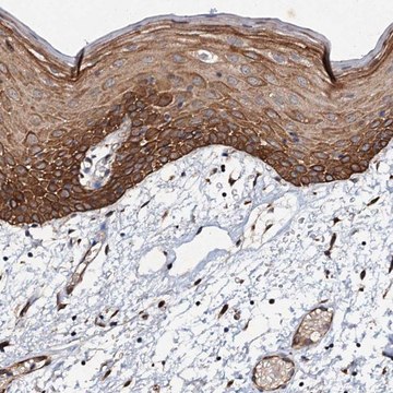 Anti-ADAMTS10 antibody produced in rabbit Prestige Antibodies&#174; Powered by Atlas Antibodies, affinity isolated antibody, buffered aqueous glycerol solution