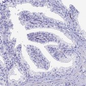 Anti-HSPA1L antibody produced in rabbit Prestige Antibodies® Powered by Atlas Antibodies, affinity isolated antibody, buffered aqueous glycerol solution