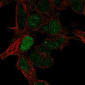 Anti-ARHGAP8 antibody produced in rabbit Prestige Antibodies® Powered by Atlas Antibodies, affinity isolated antibody
