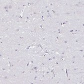 Anti-PGLYRP1 antibody produced in rabbit Prestige Antibodies® Powered by Atlas Antibodies, affinity isolated antibody, buffered aqueous glycerol solution