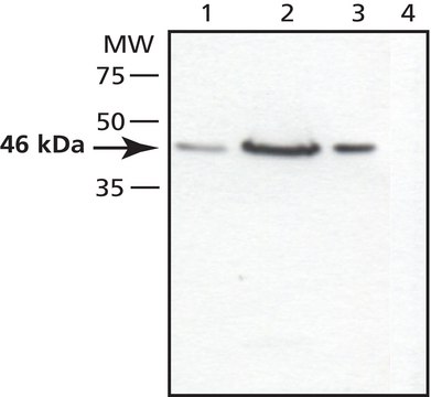 Anti-TSG101 (C-terminal) antibody produced in rabbit ~1.5&#160;mg/mL, affinity isolated antibody, buffered aqueous solution