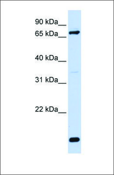 抗-ACSL4 兔抗 affinity isolated antibody