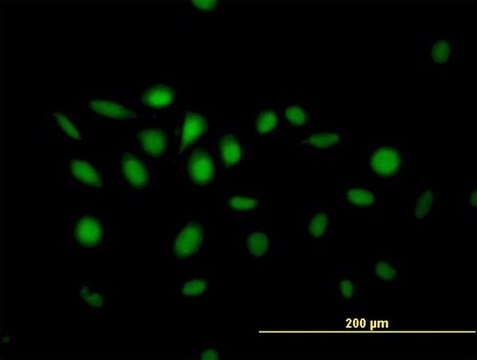 Anti-NFIX antibody produced in mouse purified immunoglobulin, buffered aqueous solution