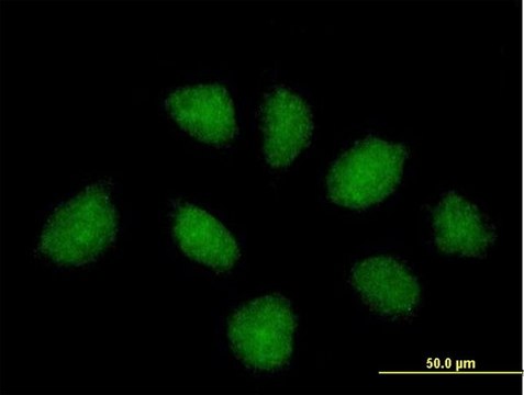 Anti-C1ORF164 antibody produced in mouse purified immunoglobulin, buffered aqueous solution