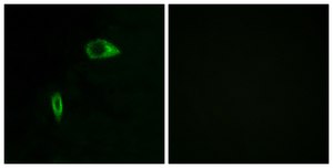 Anti-Collagen XIV α1, N-Terminal antibody produced in rabbit affinity isolated antibody