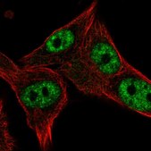 Anti-POLR3D antibody produced in rabbit Prestige Antibodies® Powered by Atlas Antibodies, affinity isolated antibody, buffered aqueous glycerol solution
