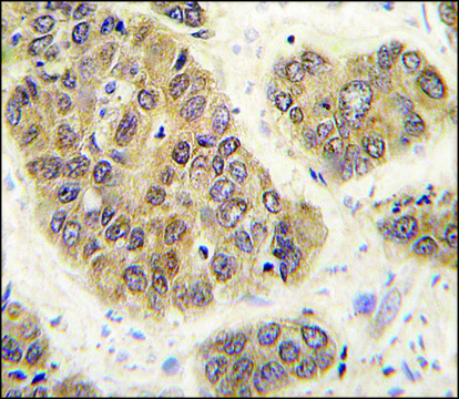 Anti-SUMO4 (M55 Wild type) antibody produced in rabbit saturated ammonium sulfate (SAS) precipitated, buffered aqueous solution