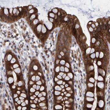 抗-LRBA 兔抗 Prestige Antibodies&#174; Powered by Atlas Antibodies, affinity isolated antibody, buffered aqueous glycerol solution, Ab2