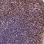Anti-DDX19A antibody produced in rabbit Prestige Antibodies® Powered by Atlas Antibodies, affinity isolated antibody, buffered aqueous glycerol solution