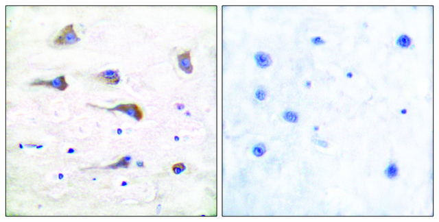 Anti-MGLUR6 antibody produced in rabbit affinity isolated antibody