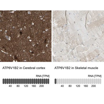 Anti-ATP6V1B2 antibody produced in rabbit Prestige Antibodies&#174; Powered by Atlas Antibodies, affinity isolated antibody, buffered aqueous glycerol solution