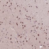 Anti-CHMP4B antibody produced in rabbit Prestige Antibodies® Powered by Atlas Antibodies, affinity isolated antibody, buffered aqueous glycerol solution