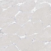 Anti-ZDHHC4 antibody produced in rabbit Prestige Antibodies® Powered by Atlas Antibodies, affinity isolated antibody, buffered aqueous glycerol solution