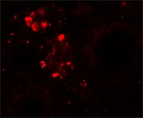 Anti-WDR92 antibody produced in rabbit affinity isolated antibody, buffered aqueous solution