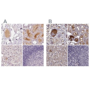 Anti-AFM antibody produced in rabbit Prestige Antibodies&#174; Powered by Atlas Antibodies, affinity isolated antibody, buffered aqueous glycerol solution