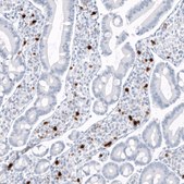 Monoclonal Anti-S100A9 antibody produced in mouse Prestige Antibodies® Powered by Atlas Antibodies, clone CL11191, purified antibody (Protein A)