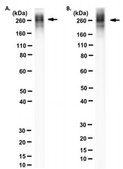 Anti-Aggrecan Core Protein Antibody, clone Cat-315