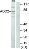 Anti-ADD2 antibody produced in rabbit affinity isolated antibody