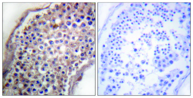 Anti-EFNB1 antibody produced in rabbit affinity isolated antibody