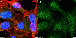 Anti-MBNL1 Antibody, clone 1H11 ZooMAb® Rabbit Monoclonal recombinant, expressed in HEK 293 cells