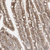 Anti-AOC1 antibody produced in rabbit Prestige Antibodies® Powered by Atlas Antibodies, affinity isolated antibody, buffered aqueous glycerol solution