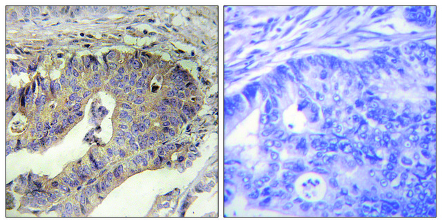 Anti-Fibrillin-1 antibody produced in rabbit affinity isolated antibody